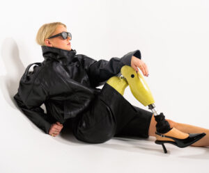 Anouk verloor haar been